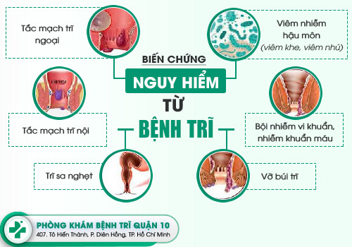 khám hậu môn ở đâu