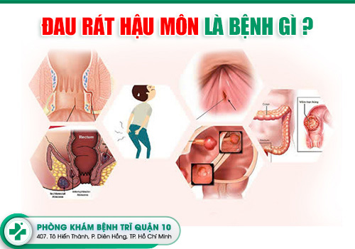 Nguyên nhân gây đau rát hậu môn là gì?