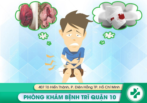 Sa hậu môn trực tràng dễ nhầm lẫn với bệnh trĩ