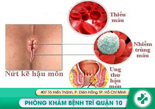 Biến chứng nguy hiểm của bệnh rách hậu môn